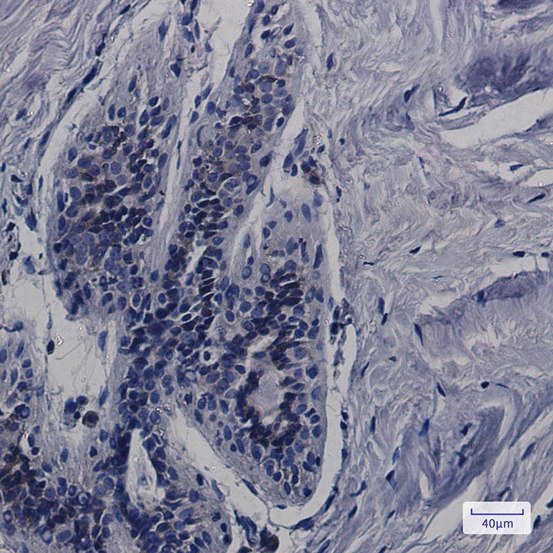 CDK5RAP3 Antibody