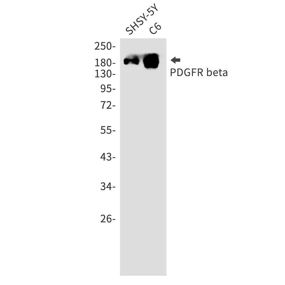 [KO] PDGFR beta Rabbit mAb