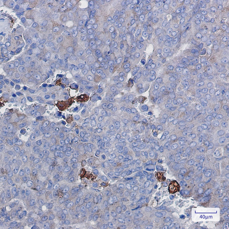 Amyloid Precursor Protein Rabbit mAb