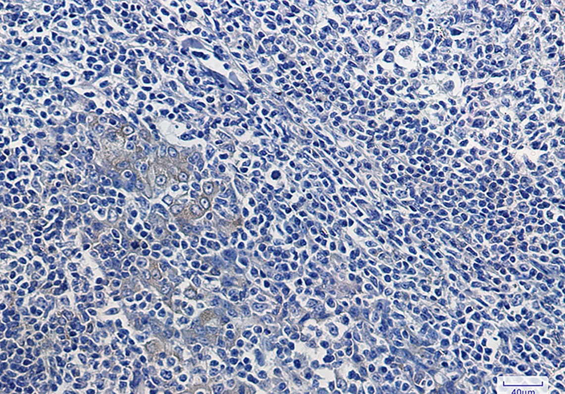 NFKBIA Antibody