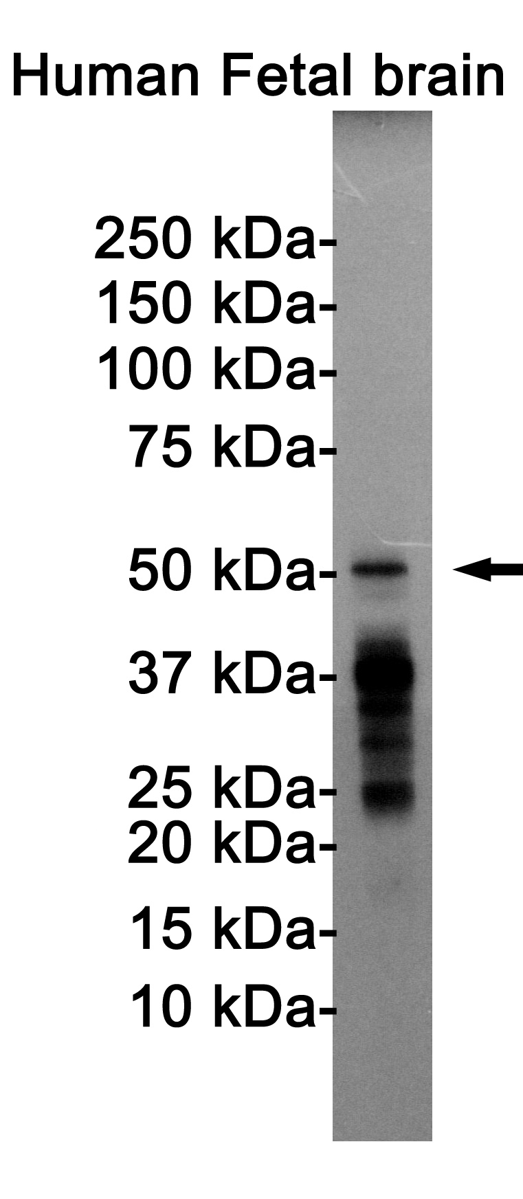MAPT Antibody