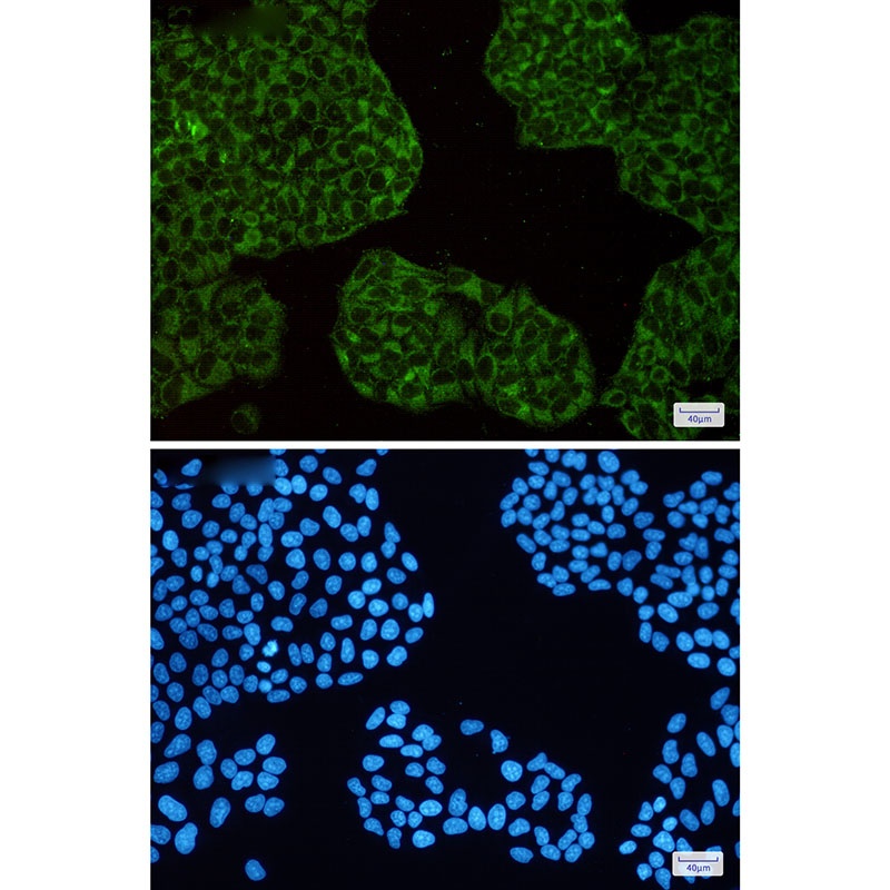FTH1 Antibody