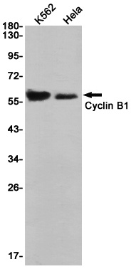 [KD] Cyclin B1 Rabbit mAb