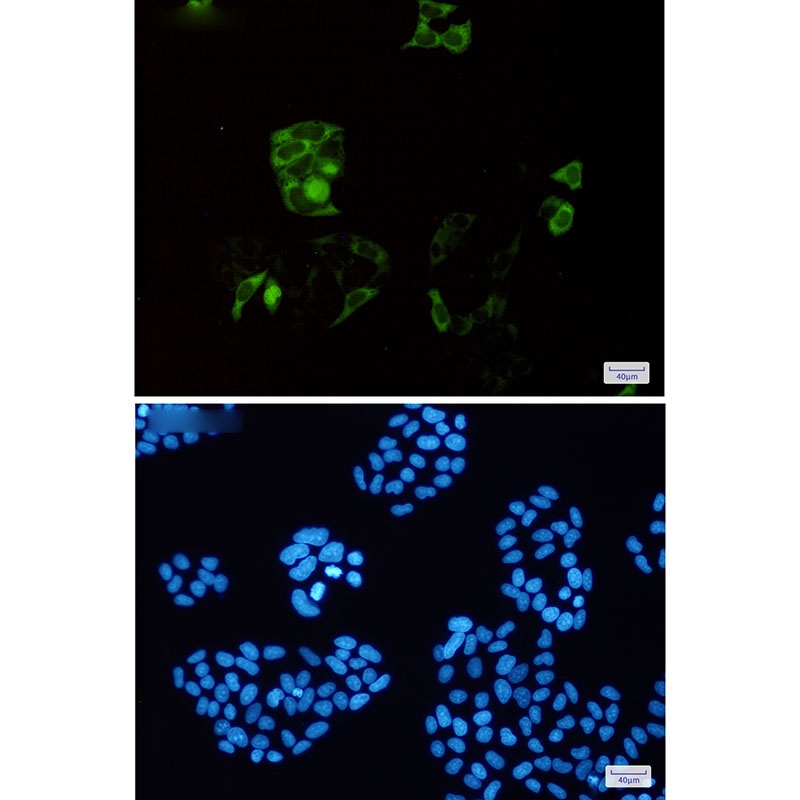 [KD] Cyclin B1 Rabbit mAb