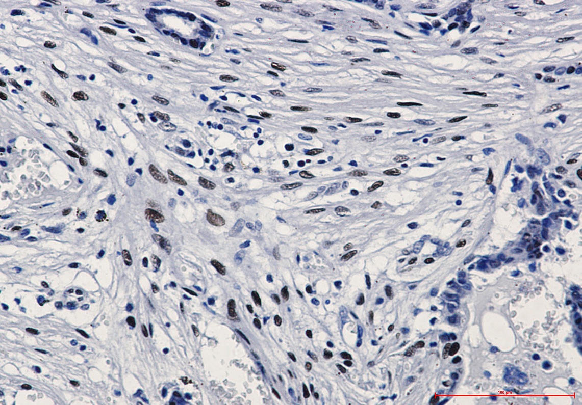 JUN Antibody