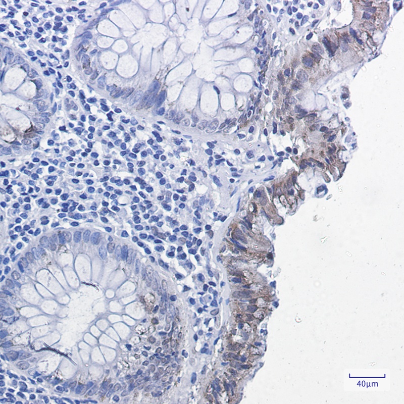 SMAD2 Antibody
