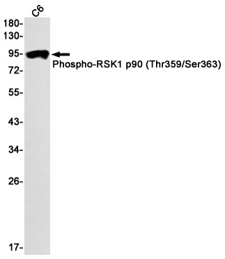 Phospho-RSK1 p90 (Thr359/Ser363) Rabbit mAb