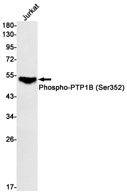 PTPN1 Antibody