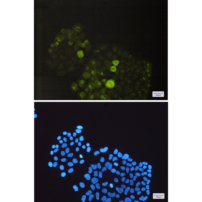 PTPN1 Antibody