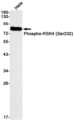 RPS6KA6 Antibody