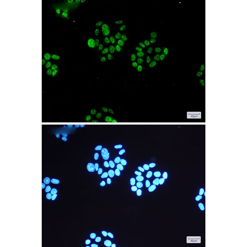 RPS6KA5 Antibody