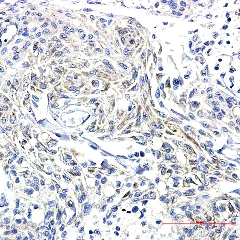 SYN1 Antibody