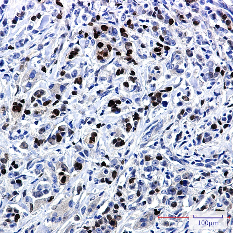 SOX9 Antibody