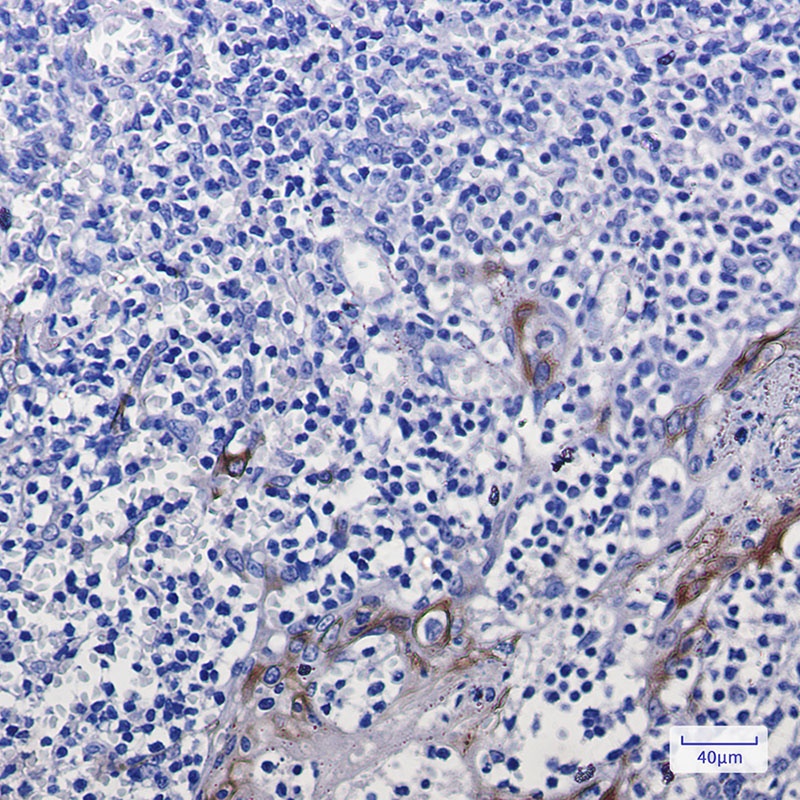 Cytokeratin 10 Rabbit mAb