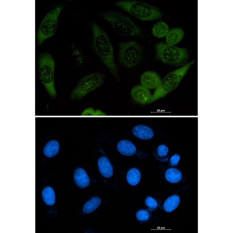 PFN1 Antibody