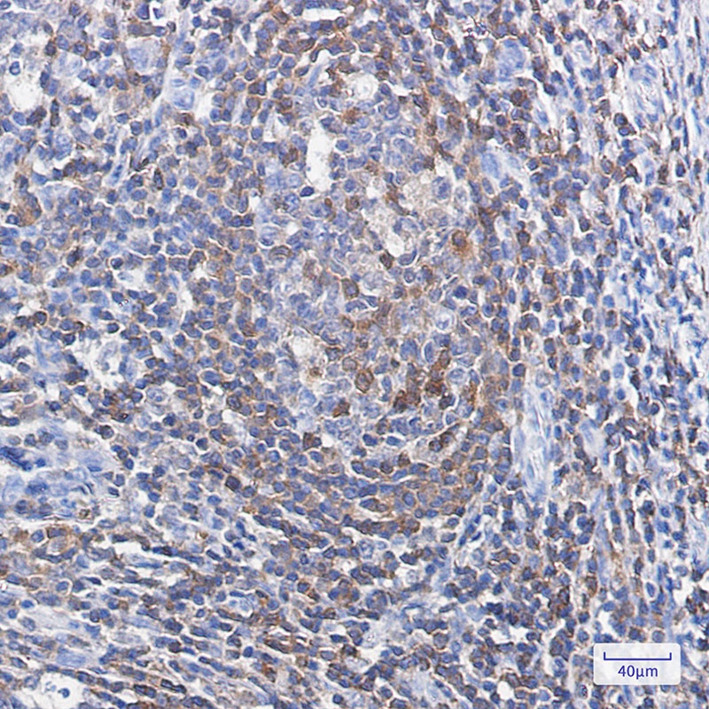 PFN1 Antibody