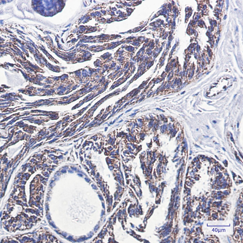 TSPO Antibody