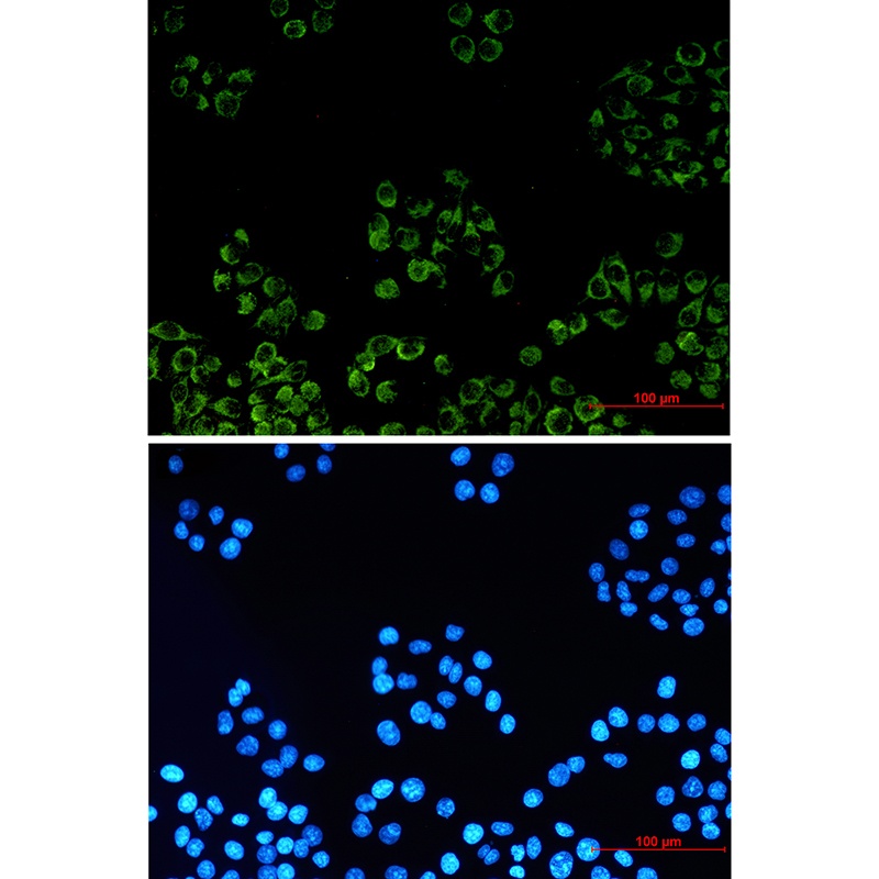 TSPO Antibody