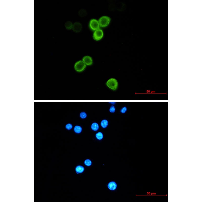 AGR2 Antibody