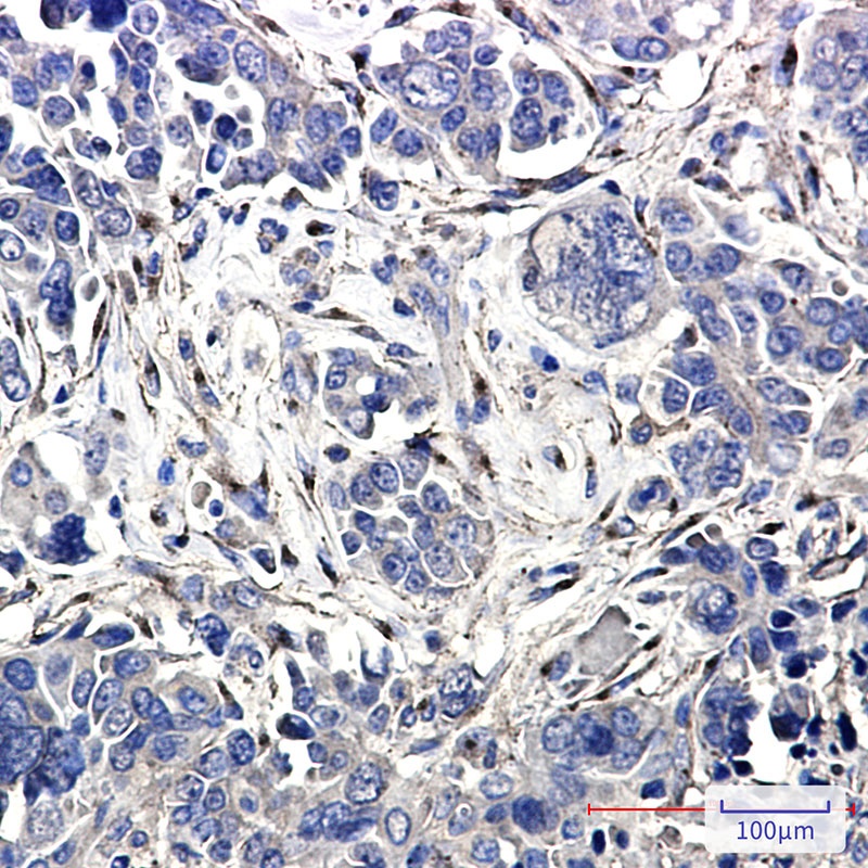 LRP1 Antibody