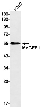 MAGEC2 Antibody