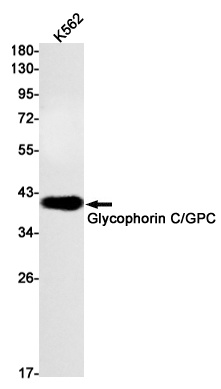 Glycophorin C Rabbit mAb