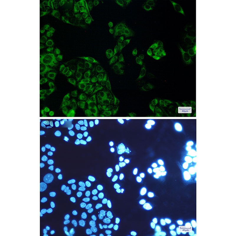 FDFT1 Antibody