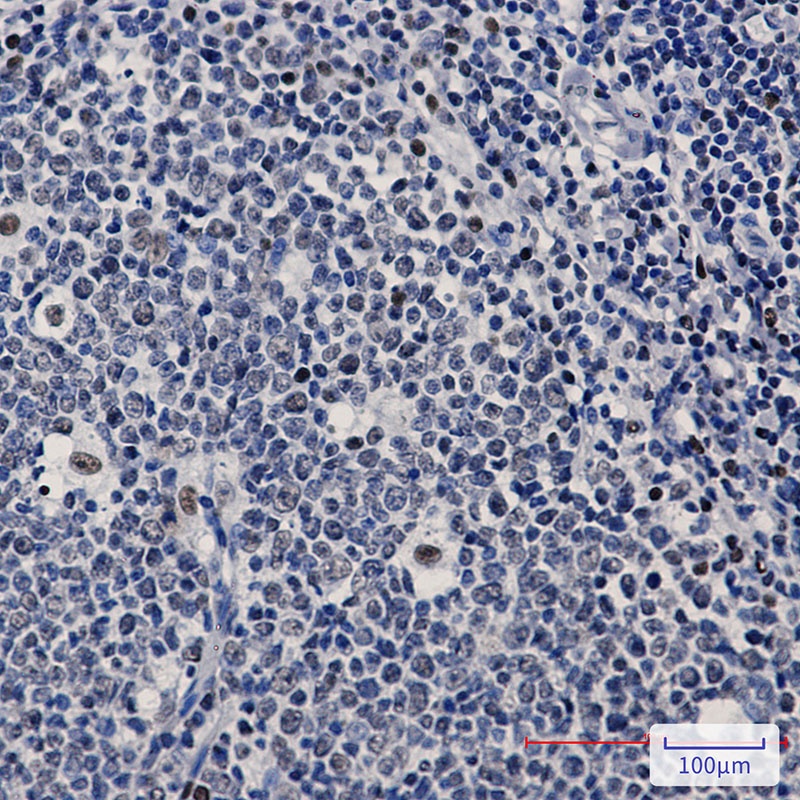 PREB Antibody