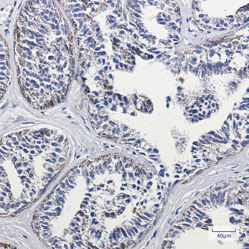 DLD Antibody