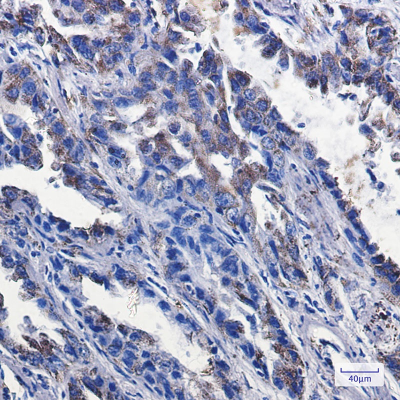 P2Y6 Rabbit mAb