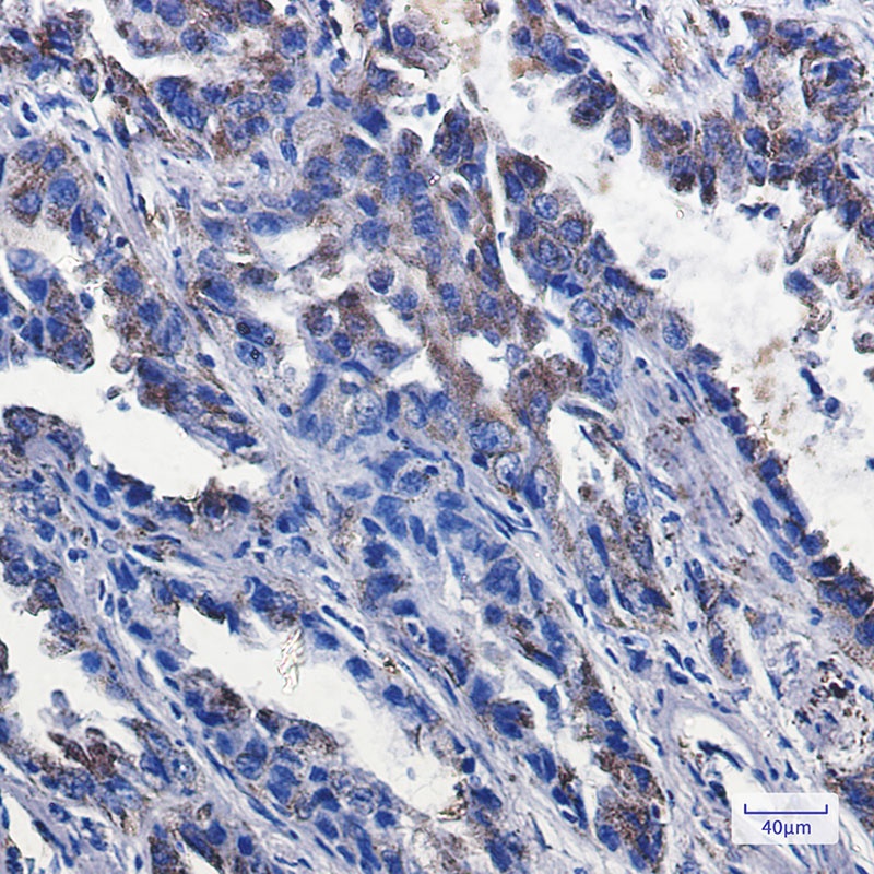 P2RY6 Antibody