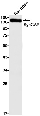 SynGAP Rabbit Monoclonal Antibody
