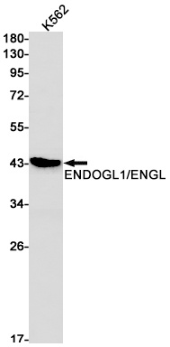 ENDOGL1 Rabbit mAb