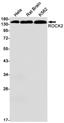 ROCK2 Antibody