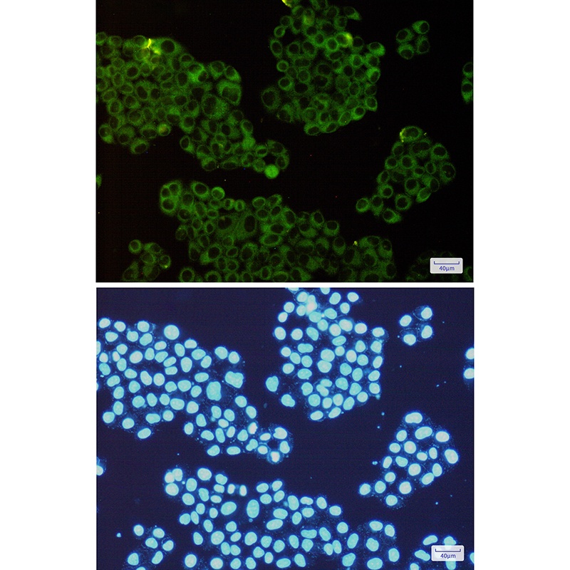 ROCK2 Antibody