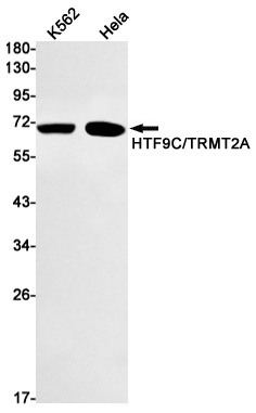 TRMT2A Antibody