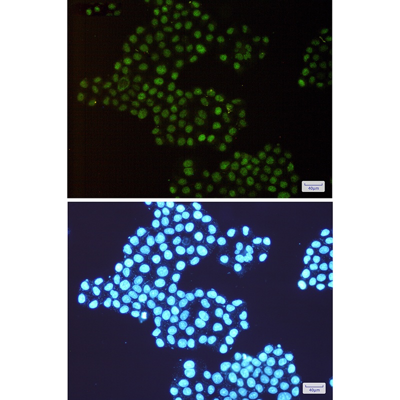 TRMT2A Antibody