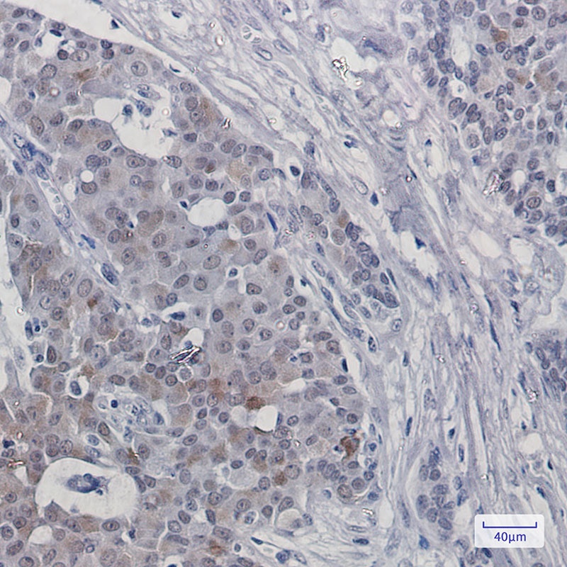 TRMT2A Antibody