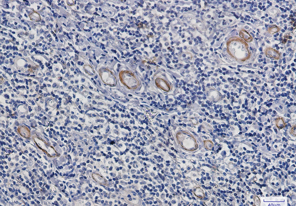 ASNS Antibody