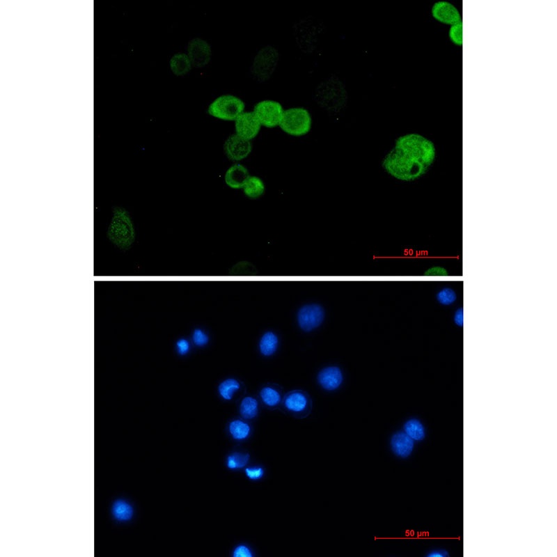 [KO] CRABP2 Rabbit mAb