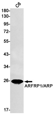 ARFRP1/ARP Rabbit Monoclonal Antibody