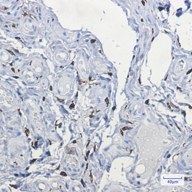 F13A1 Antibody