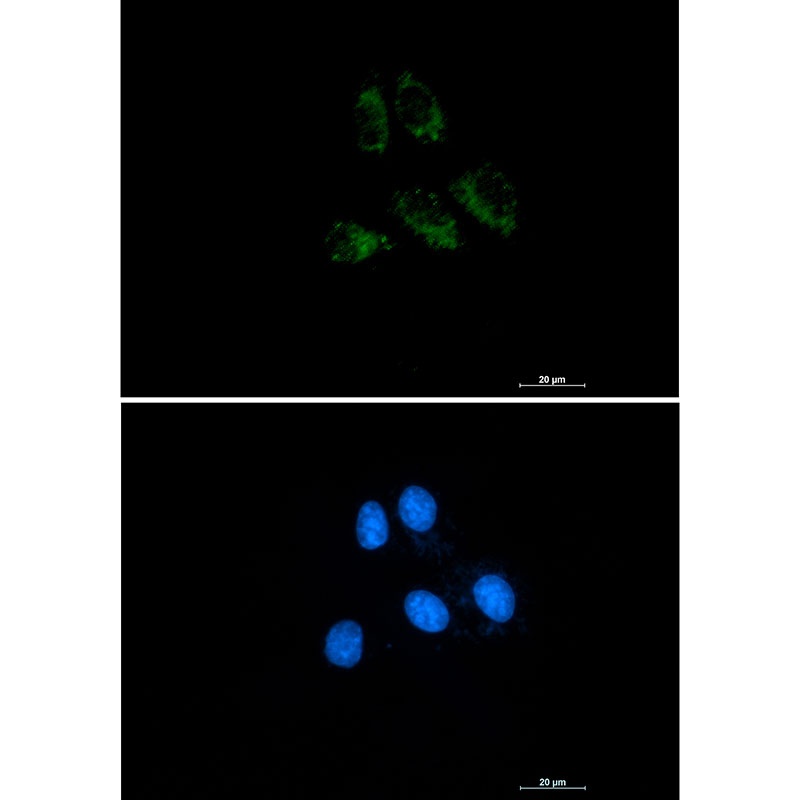 Thrombomodulin Rabbit mAb