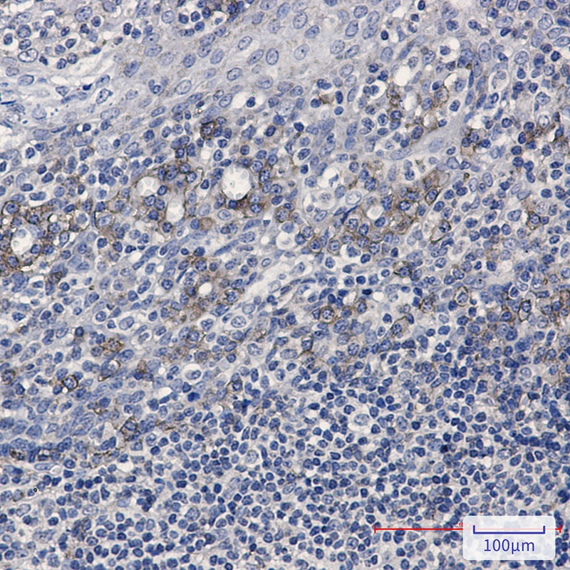 CD32B Rabbit Monoclonal Antibody