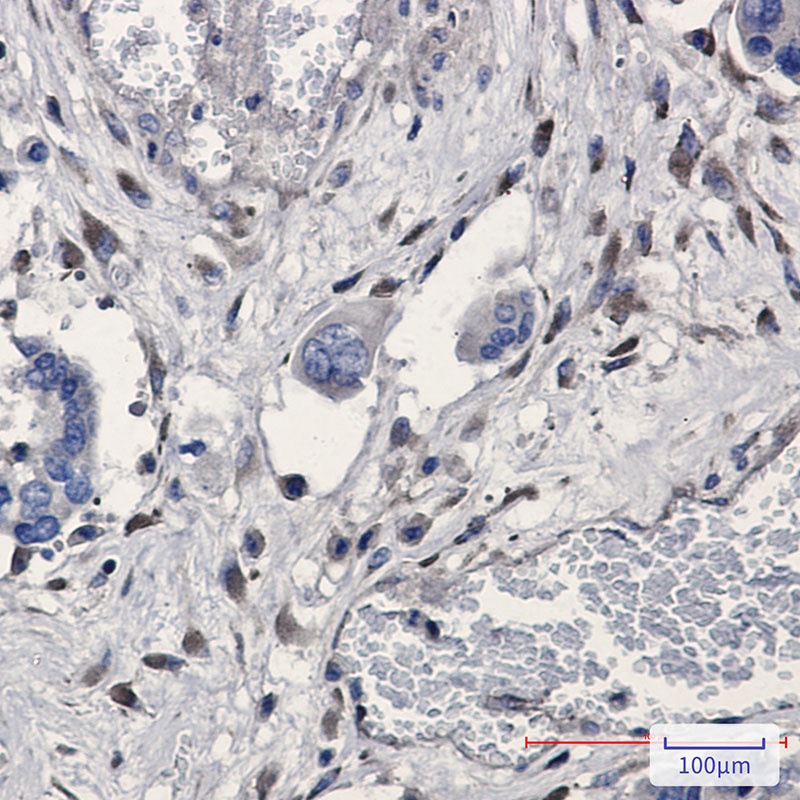 GNB2 Rabbit mAb