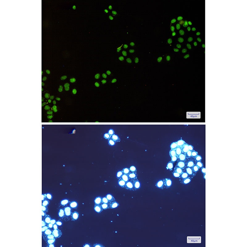 NAT10 Rabbit mAb