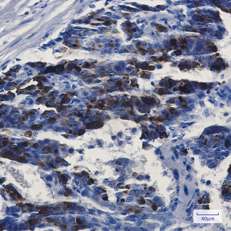 MMP14 Antibody