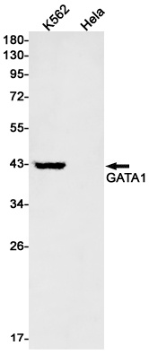 GATA1 Rabbit mAb