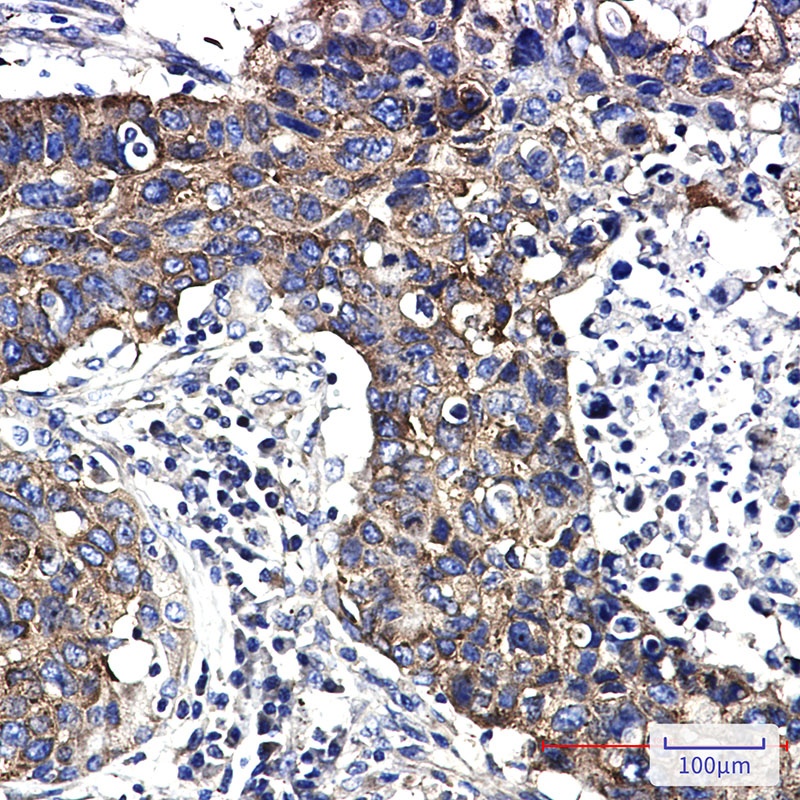 FMR1 Antibody