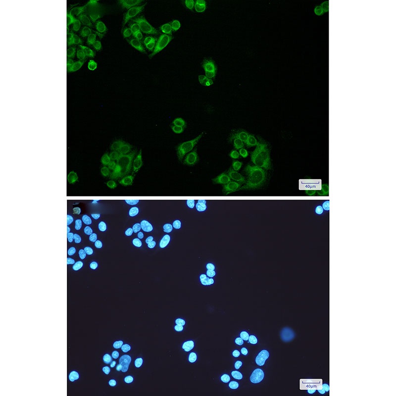 ELOVL5 Rabbit mAb